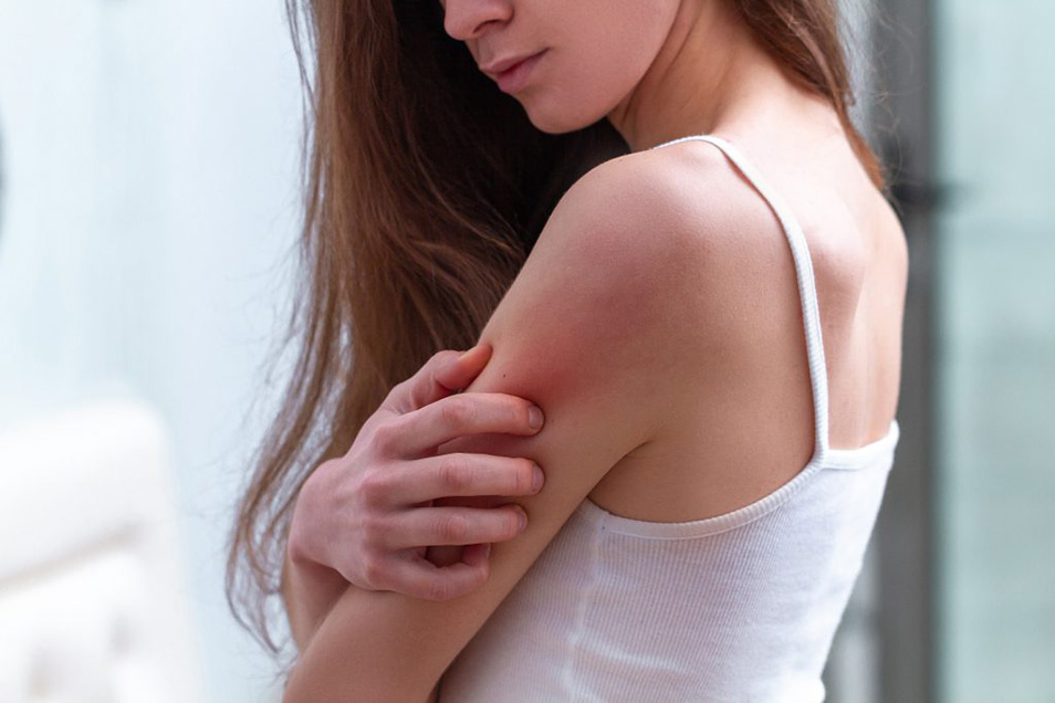 Phát ban da là trường hợp hiếm gặp khi bổ sung lợi khuẩn